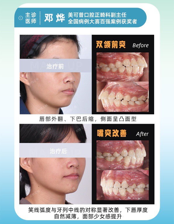 案例3.jpg