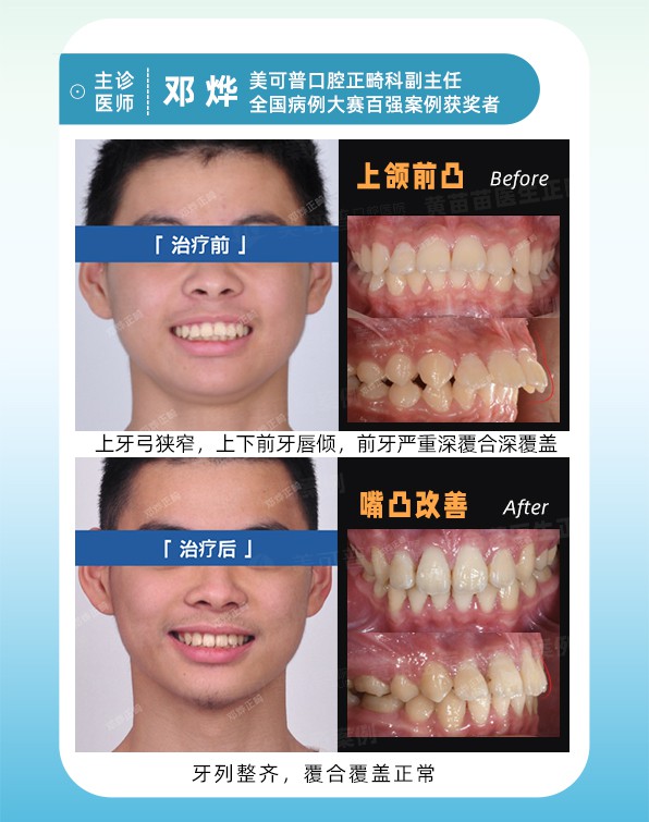 案例1.jpg