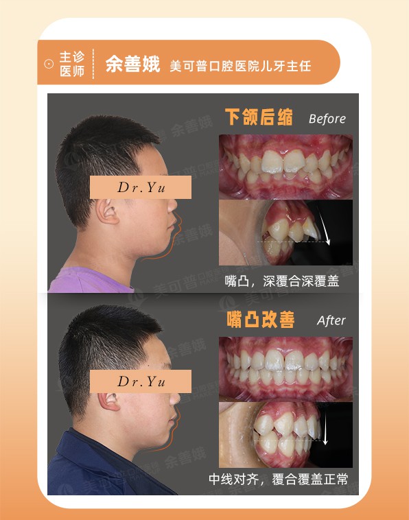 案例1.jpg