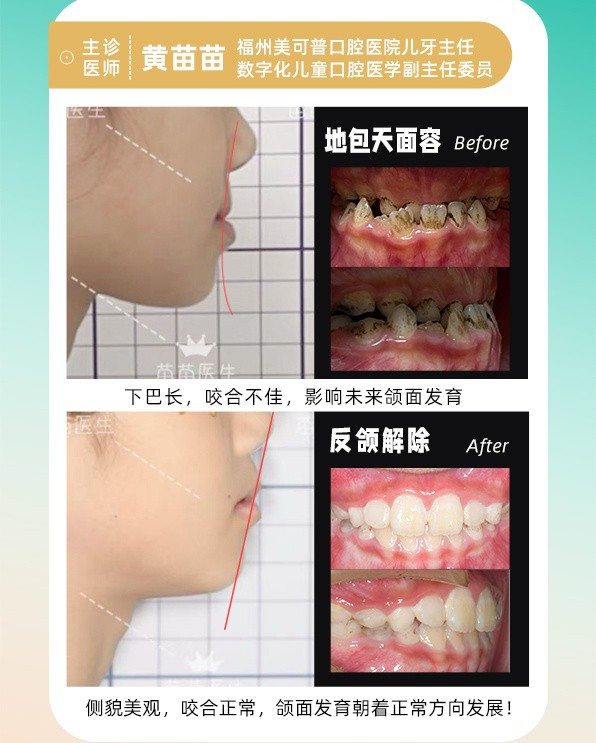 案例1.jpg