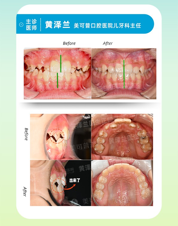案例1.jpg