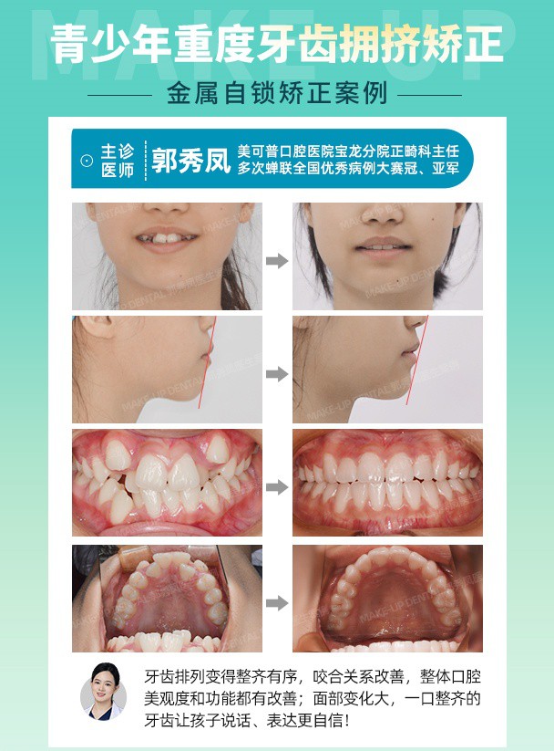 250812-郭秀凤朋友圈案例.jpg