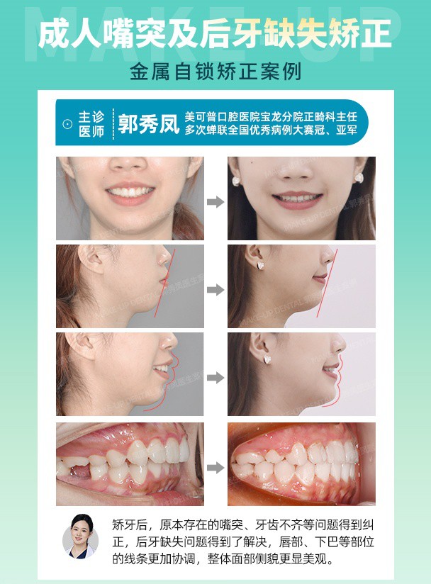 250822-郭秀凤朋友圈案例.jpg