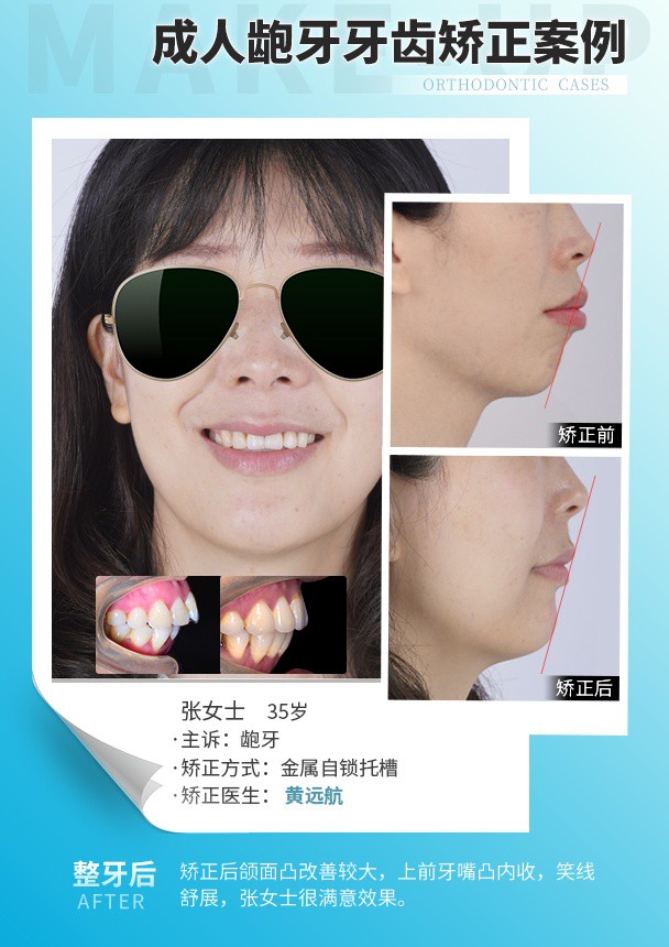 250701-黄远航案例.jpg