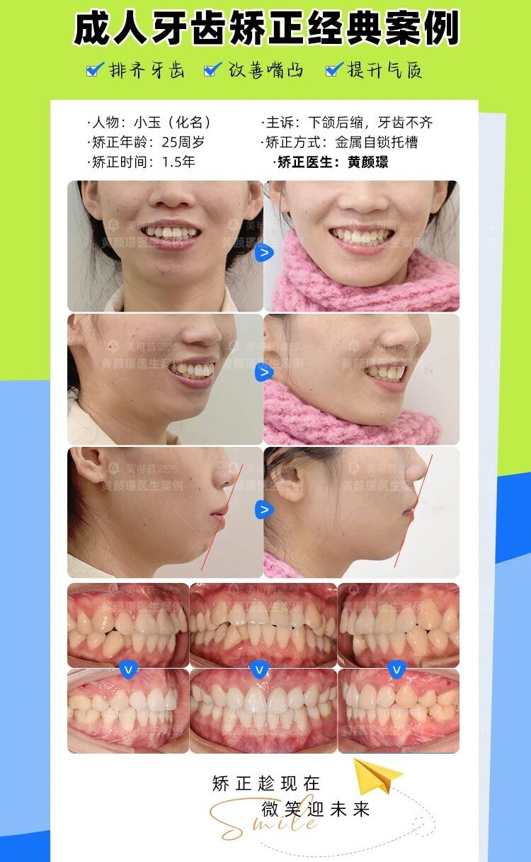 案例4.jpg
