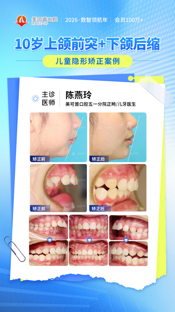 陈燕玲 -美可普口腔正畸医生