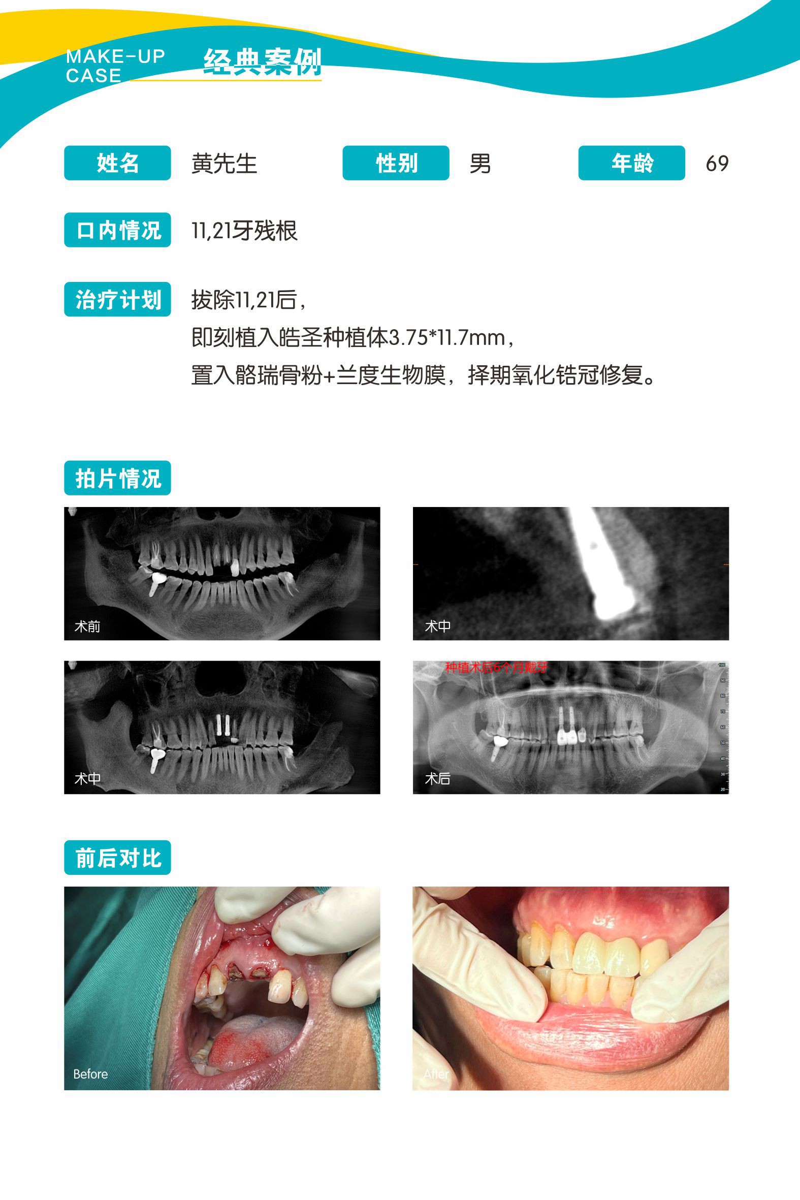 案例1.jpg