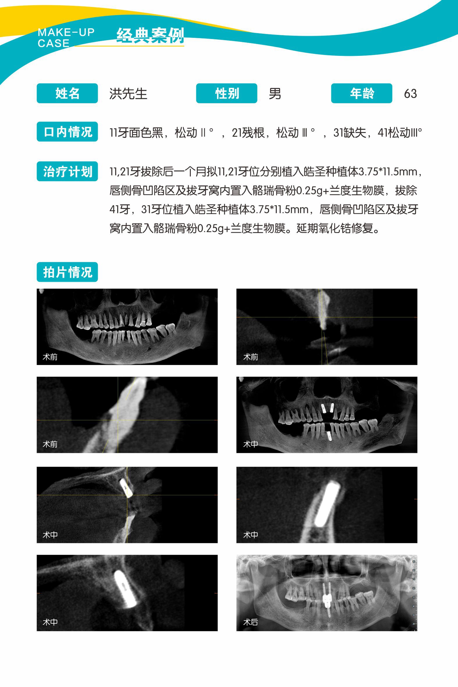 案例2.jpg