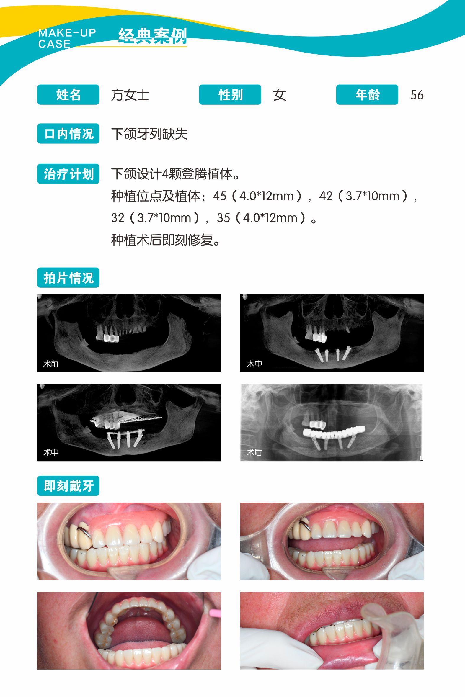 案例4.jpg