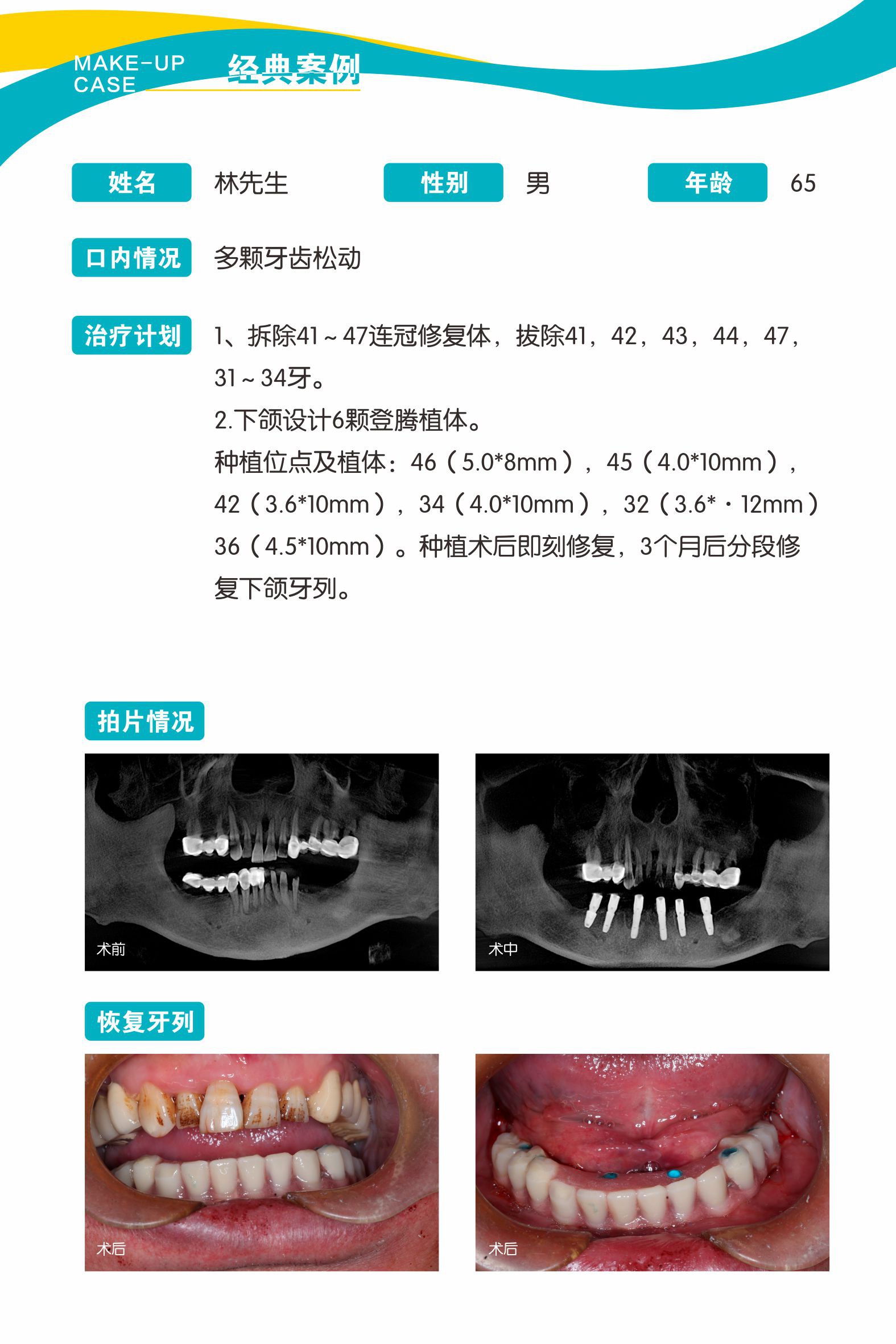 案例3.jpg