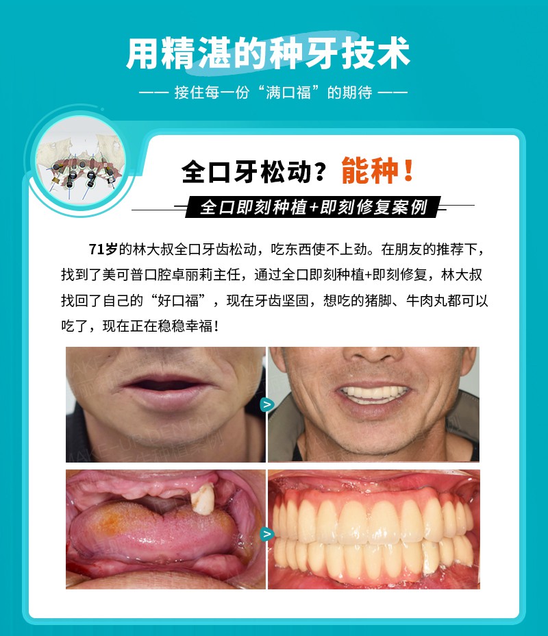 案例1.jpg