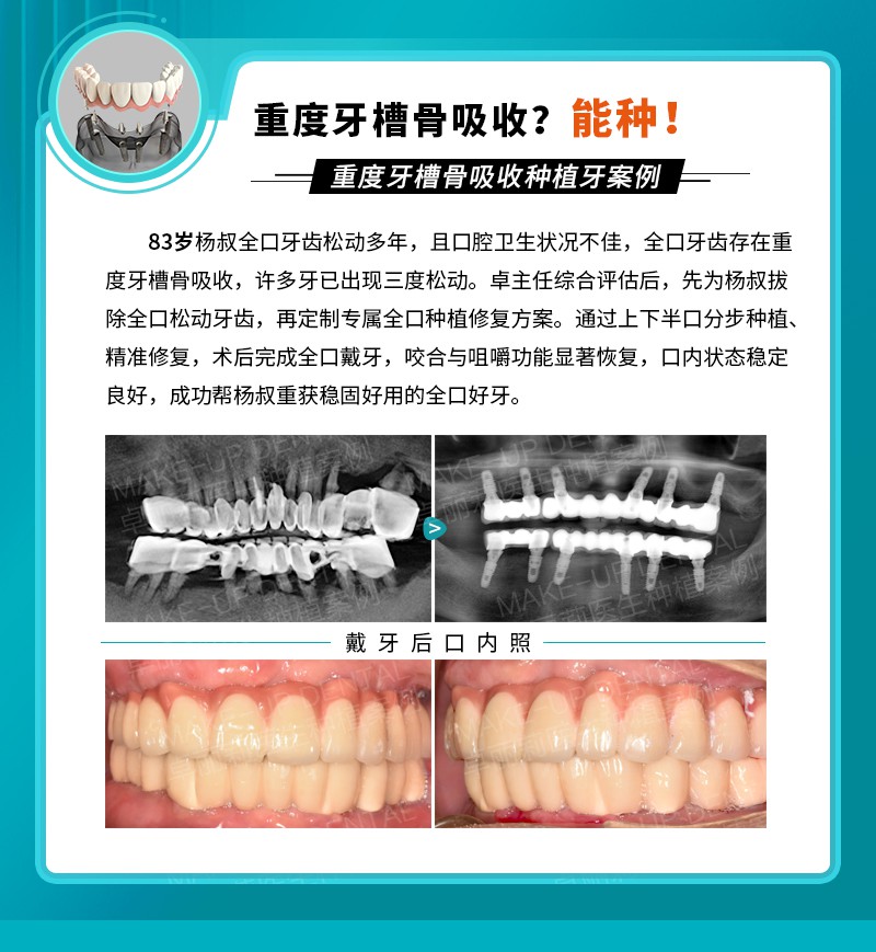 案例3.jpg
