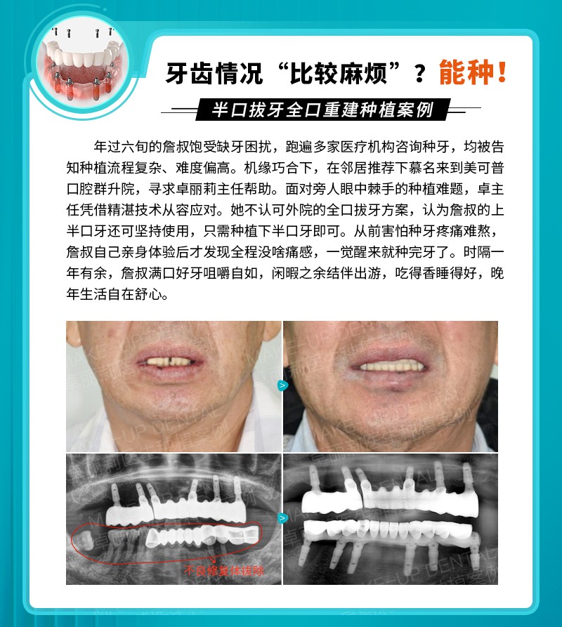 案例2.jpg