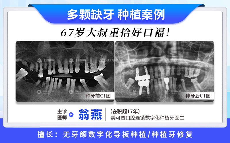 案例1.png