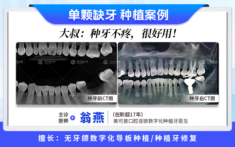 案例3.png