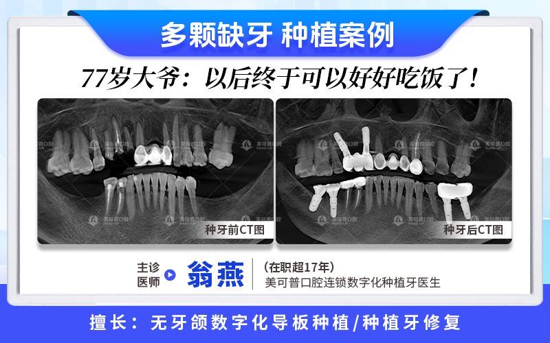案例2.png