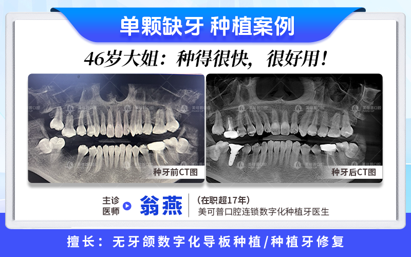 案例4.png
