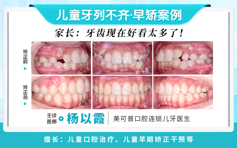 杨以霞1.png