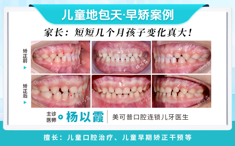 杨以霞2.png